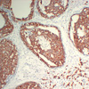 14-3-3 protein epsilon/YWHAE, Human Recombinant